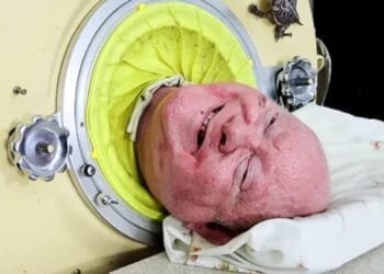 États-Unis : Après une lutte de 72 ans contre la polio, Paul Alexander, qui vivait dans un “poumon de fer”, nous a quittés.